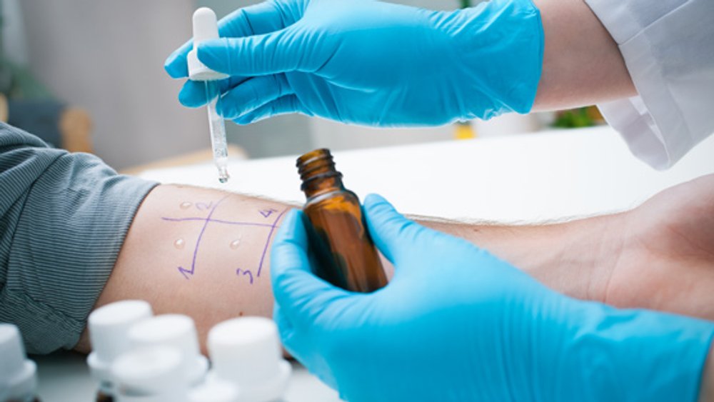 Pricktest bei Allergien