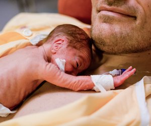 Welches Perinatalzentrum ist für extreme Frühchen das richtige?